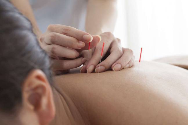 Research finds acupuncture is effective for chronic pain